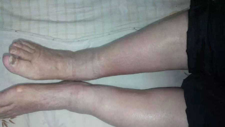 56.jpg