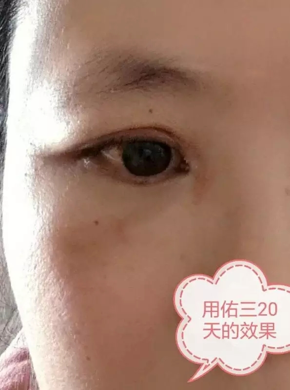 5.webp.jpg