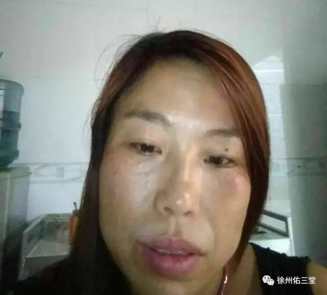 1.webp.jpg