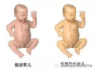 1.webp.jpg