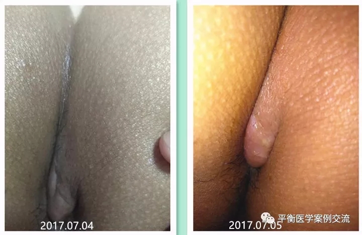 2.webp.jpg