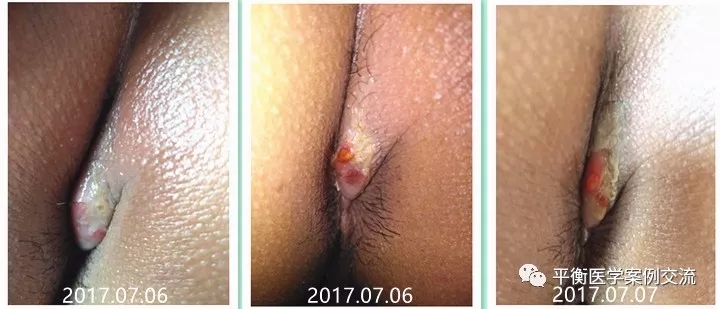 3.webp.jpg