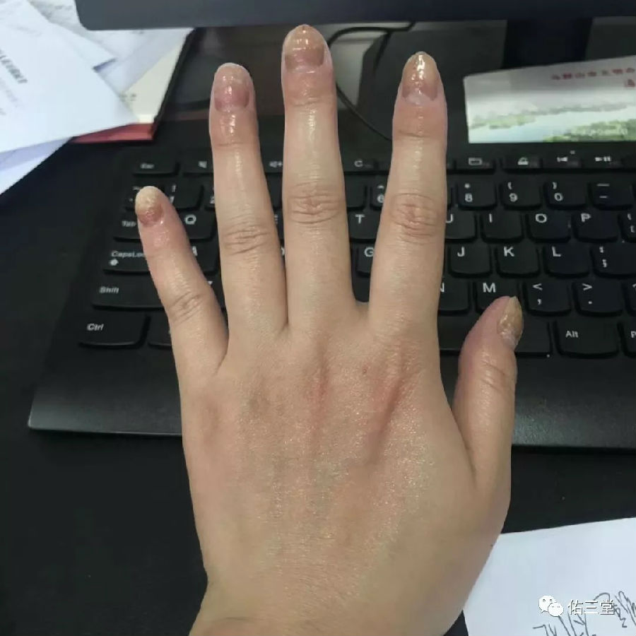 5.webp.jpg