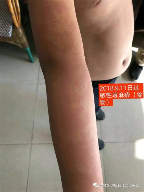 5.webp.jpg